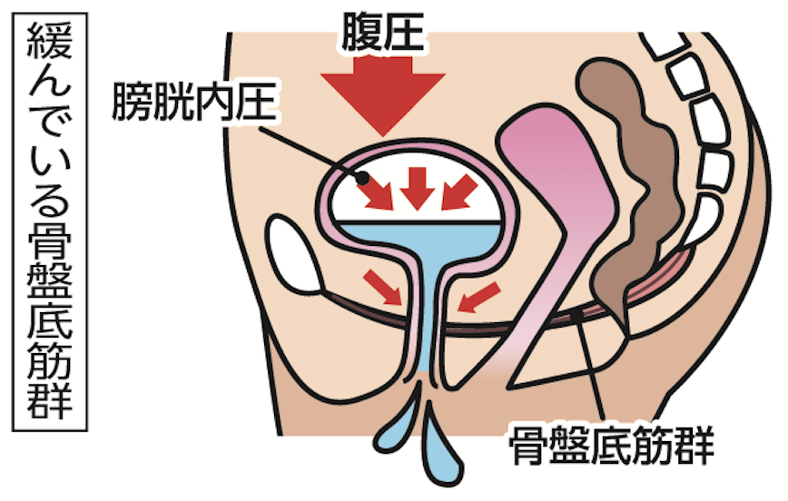 図2骨盤緩んでいる.png