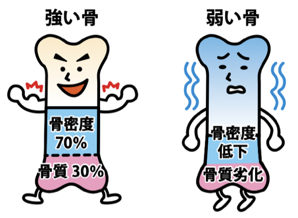 図3 骨の強さを構成する要素